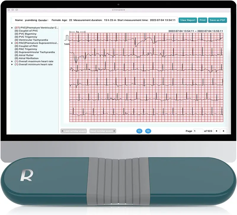 Ai-Powered Wireless Ecg Monitor – 24-Hour Holter Recorder With Cross-Platform Software (Windows/Macos) 1