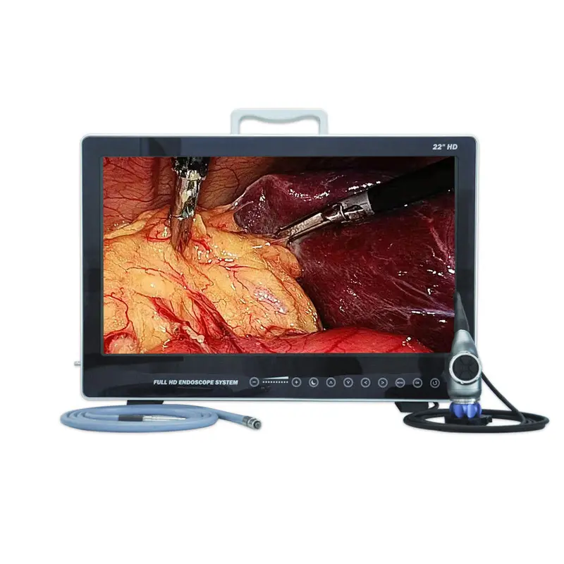 All-In-One Hd Portable Endoscope Camera System – Compatible With Ent, Laparoscopy, Hysteroscopy & Urology 1
