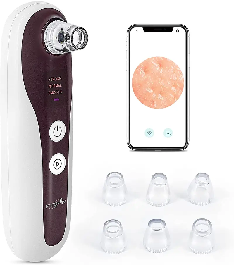 Camera-Equipped Blackhead Vacuum Kit – Led Pore Imaging Suction Device (Model Mb7612) 1