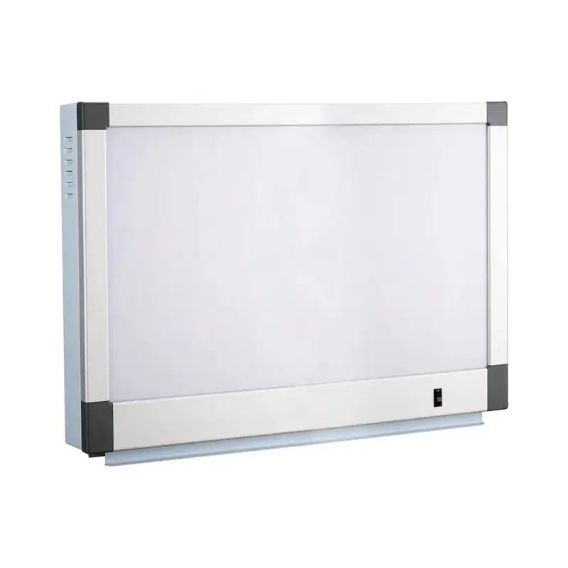 Cypdfa1 Dual-Film Led X-Ray Viewer – Medical Light Panel For Simultaneous Radiograph Comparison 1