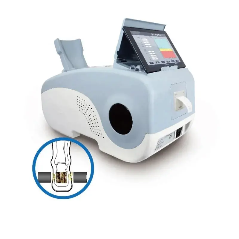 Dual-Energy X-Ray Absorptiometry (Dexa) Bone Densitometer – Pediatric & Adult Osteoporosis Screening 1
