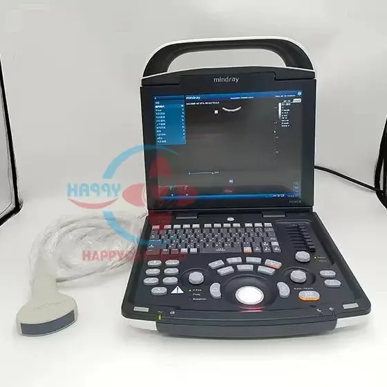 Full-Digital Portable Led Ultrasound Scanner For Bedside And Field Use 1