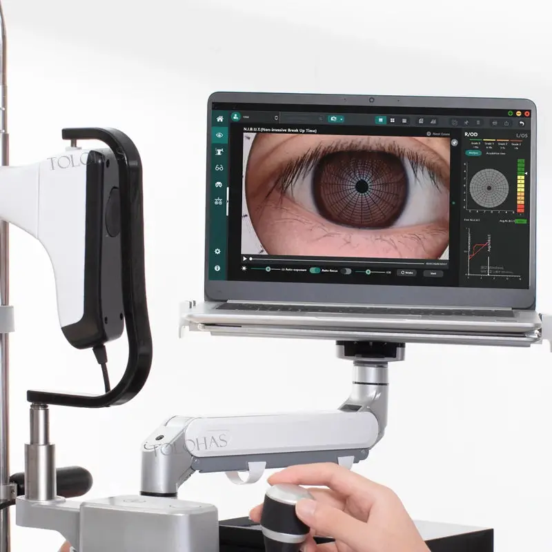 Integrated Dry Eye Analyzer – Ophthalmic Diagnostic Device For Tear Film Assessment 1