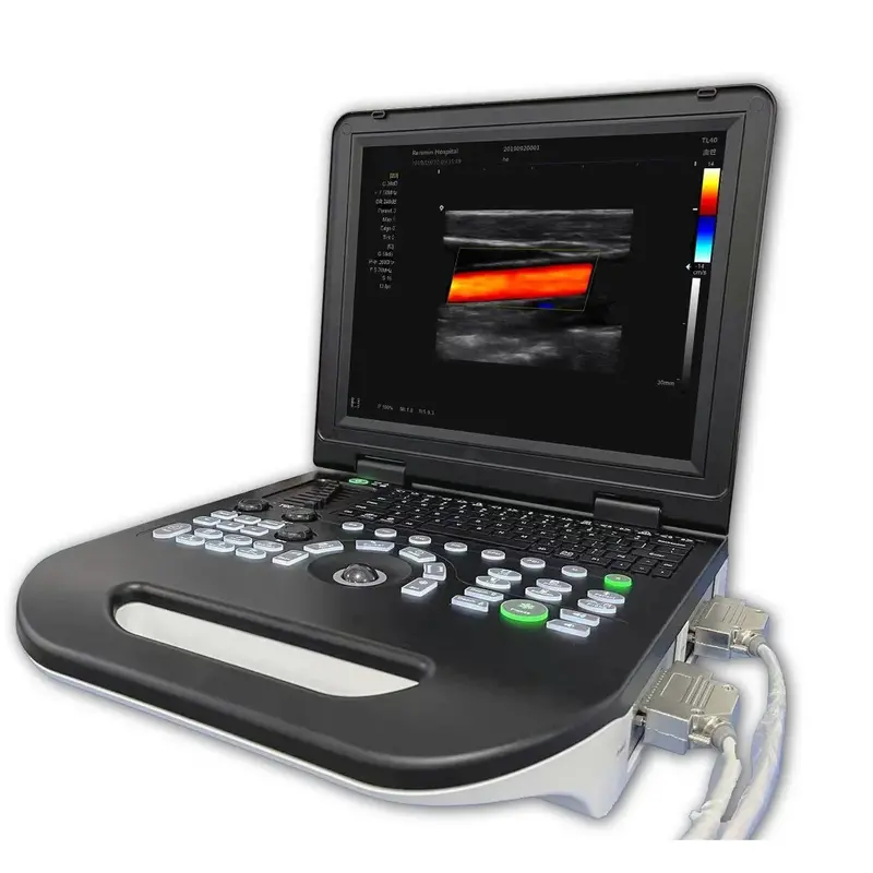 Laptop-Based 3D Color Doppler Ultrasound – Portable, Hospital-Grade Diagnostic Imaging System 1