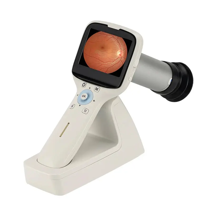 Meubon Mhfc1 Hd Fundus Camera — Lightweight Handheld Eye Imaging Device With High-Definition Capture 1