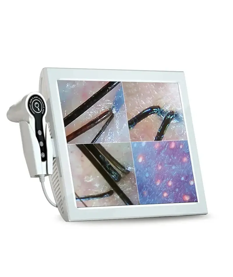 Meubon Mk77845 Hd Skin & Scalp Analyzer – 15-Inch Professional Follicle, Oil, And Hydration Assessment Camera 1