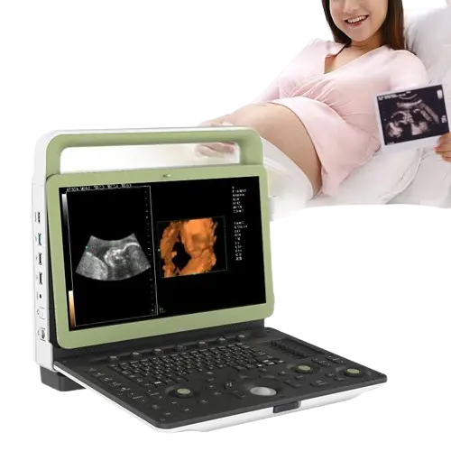 Mnslcu78 Portable Diagnostic Ultrasound – Compact, High-Performance Imaging System For Clinical Use 1
