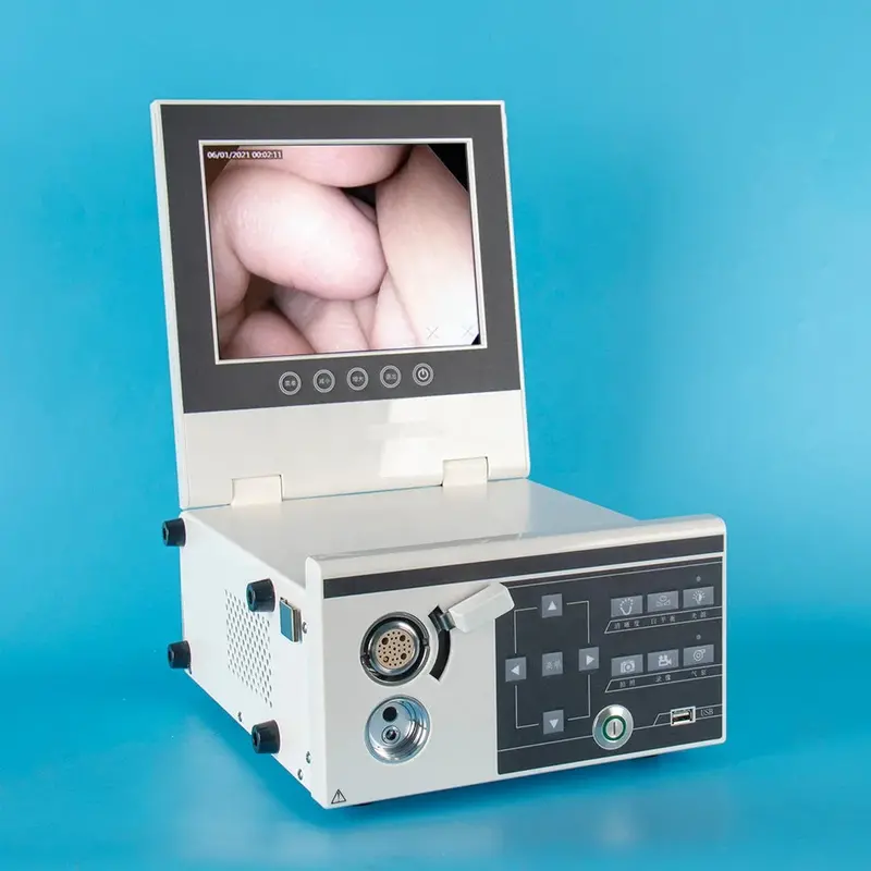 Portable Cmos Video Endoscope For Gastrointestinal And Colonic Examination 1
