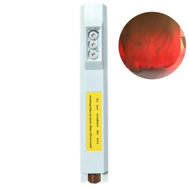 Portable Infrared Vein Finder With Rechargeable Battery – Clinical Vascular Imaging Tool 1