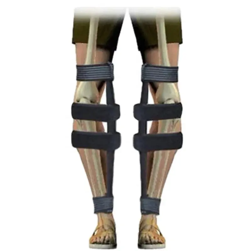 Universal Leg Alignment Corrector — Adjustable O/X-Shape Bracing Belt For All Ages 1