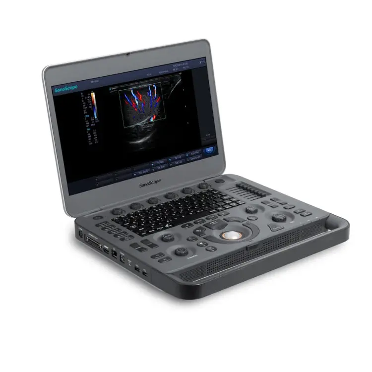 Versatile Portable Color Doppler Ultrasound: Multi-Application Probe Support For Ob/Gyn & Cardiology 1