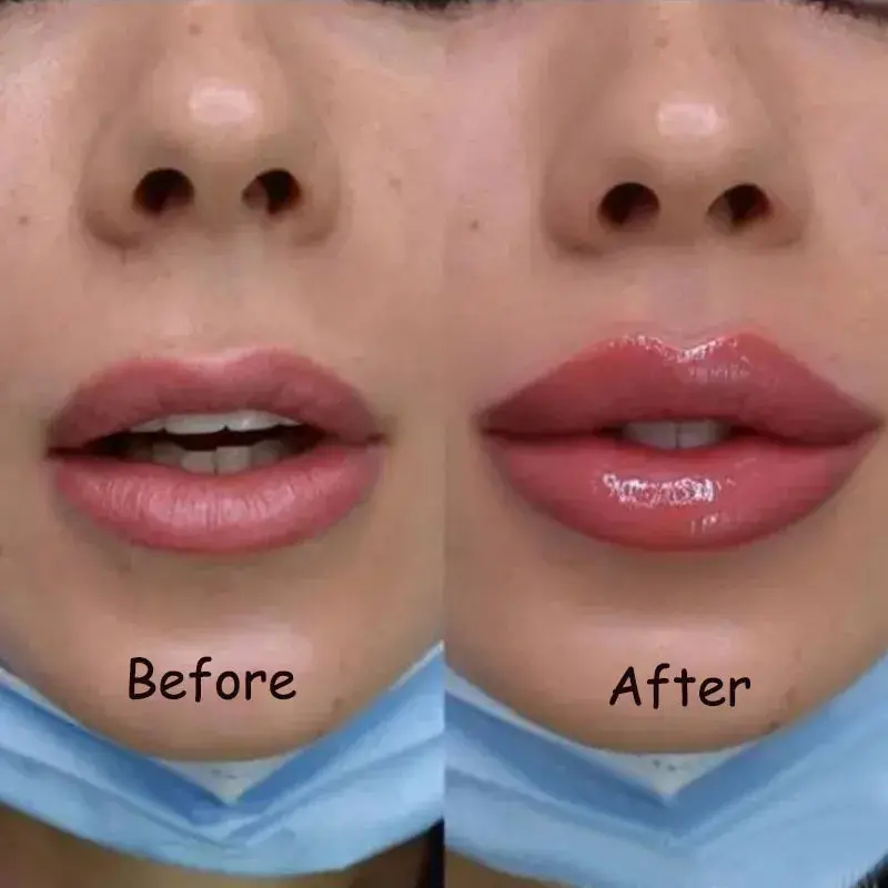 Volumizing Lip Plumping Oil – Nourishing, Anti-Wrinkle Gloss Serum 1